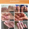 Nail Care Essence - Fingernail & Toenail Care Solution