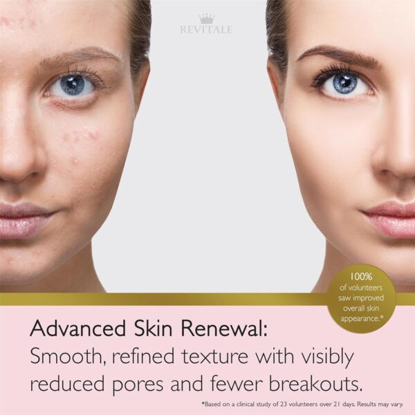 71o2s2Hib5L._AC_SL1500_.jpg Revitale Advanced Salicylic Acid Cream for Face & Body 80g – Helps Smooth & Soften Skin Texture. For Rough, Bumpy & Blemish-Prone Skin