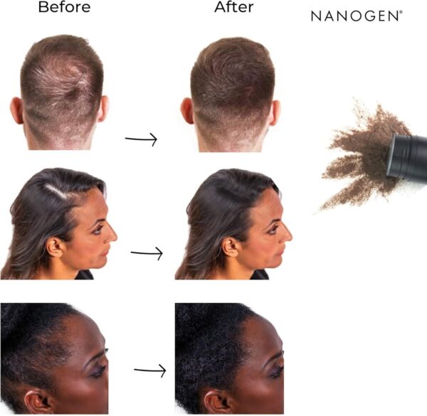 Nanogen Hair Fibres, 30 g, Dark Brown