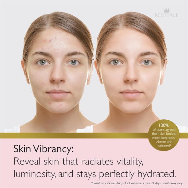 71qHSP3W9aL._AC_SL1500_.jpg Revitale Advanced Salicylic Acid Cream for Face & Body 80g – Helps Smooth & Soften Skin Texture. For Rough, Bumpy & Blemish-Prone Skin