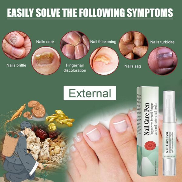 2PCS Nail Care Pen,Fungal Nail Treatment Pen,Cosmetic Care for Nail Fungus,Toenail Fungus Treatment Pen,Fungal Toenail Treatment,Antifungal Nail Polish,Nail Repair Pen for Nail