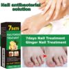 Ginger Nail Treatment Nail Support Nail Care - Ginger Nail Growth Serum, 7 Days Nail Treatment, Ginger Cuticle Care Oil for Nails, Nail Strengthener For Damaged Nails, Fungal Nail Treatment