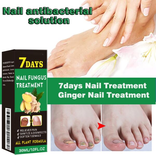 Ginger Nail Treatment Nail Support Nail Care - Ginger Nail Growth Serum, 7 Days Nail Treatment, Ginger Cuticle Care Oil for Nails, Nail Strengthener For Damaged Nails, Fungal Nail Treatment
