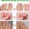 Ginger Nail Treatment Nail Support Nail Care - Ginger Nail Growth Serum, 7 Days Nail Treatment, Ginger Cuticle Care Oil for Nails, Nail Strengthener For Damaged Nails, Fungal Nail Treatment
