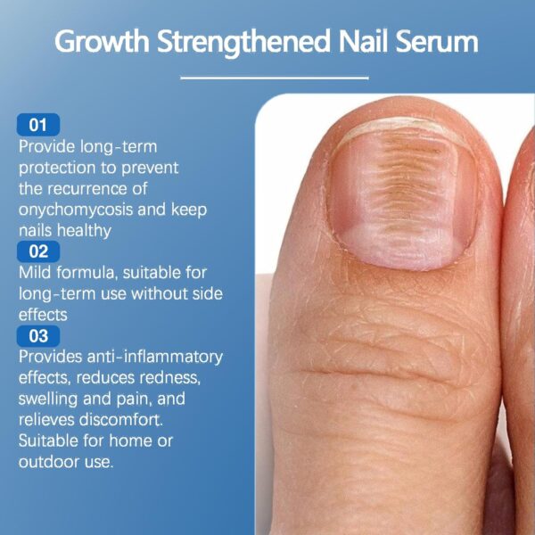 JORUN 2 Pcs Fungal Nail Treatment for Toenails Extra Strong Nail Care Serum - Natural 60 Ml Toe Nail Fungal Treatment - No Stimulation Nail Growth Treatment for Broken,Discolored Fungal Nail