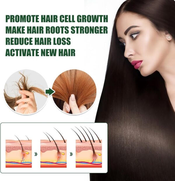 71wHWlBXeFL._AC_SL1500_.jpg Ginger Anti Hair Loss 7 Days Oil,Ginger Hair Growth Oil,Hair Loss Treatment for Women,Hair Growth Serum,Repair Damaged Hair,Ginger Hair Growth Germinal Oil,Hair Strengthening Products,Hair Thickening