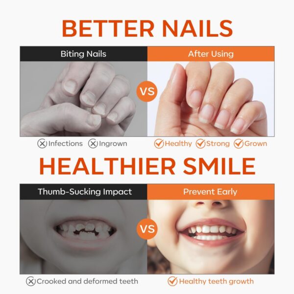 Modelones Stop Nail Biting Pen, Nail Biting Prevention, Thumb Sucking Deterrent, Nail Biting Treatment for Kids & Adults, Natural Nail Care Pen to Help Stop Nail Biting Habit, Safe Solution for Biters