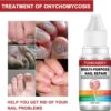 AINxtolm Fungal Nail Treatment,Nail Fungus Treatment Toenail,Toe Nail,Toenail Fungus Treatment,Fungal Nail Treatment Toenails Extra Strong,Fingernail Toenail Care Nail Repair, red, 10 millilitre