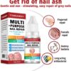 AINxtolm Fungal Nail Treatment,Nail Fungus Treatment Toenail,Toe Nail,Toenail Fungus Treatment,Fungal Nail Treatment Toenails Extra Strong,Fingernail Toenail Care Nail Repair, red, 10 millilitre
