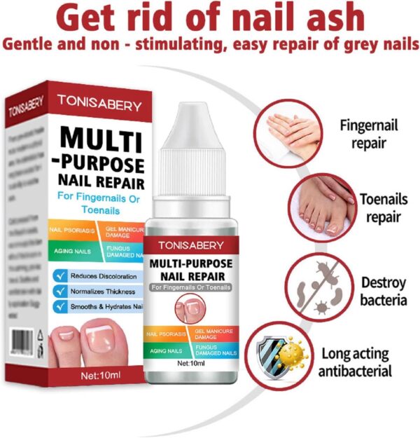 AINxtolm Fungal Nail Treatment,Nail Fungus Treatment Toenail,Toe Nail,Toenail Fungus Treatment,Fungal Nail Treatment Toenails Extra Strong,Fingernail Toenail Care Nail Repair, red, 10 millilitre
