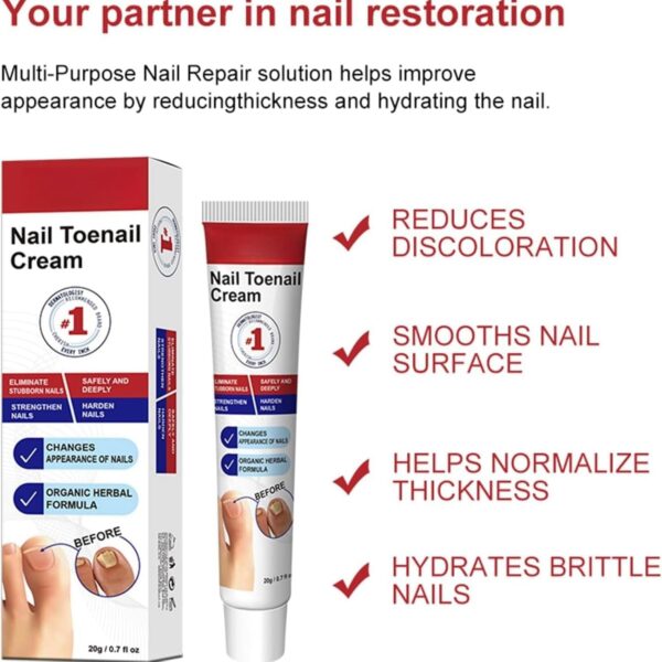 Fungal Nail Treatment Cream,Antifungal Nail Polish Cream,Nail Fungus Treatment for Toenail,Strong Anti-Fungal Toenail Cream,Nail Improve Cream,Nail Repair Cream for Thick Cracked Discolored Nails