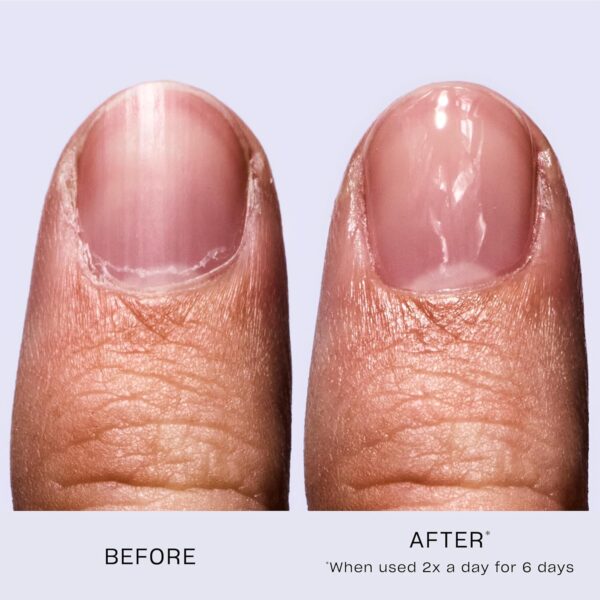 OPI Nail Envy Nail Polish, Nail Strengthener Treatment with Biotin, Calcium & Vitamins for Strong Natural Nails, Vegan Nail Repair and Strength for Damaged Nails, Clear Nail Polish 15ml
