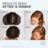 L'Oreal Paris ELVIVE Growth Booster Conditioner 150ml, Anti Hair Loss and Hair Thickening, with Aminexil & Niacinamide, Prevents & Reduces Hair Loss and Hair Thinning, Visibly Denser in up to 12 weeks