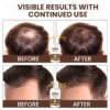 Batana Oil Hair Growth Shampoo: Natural Hair Loss Shampoo for Thinning Hair for Women and Men - Daily Hair Care at Home - 10.1 fl.oz
