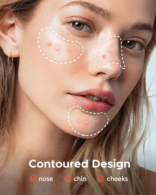 81XBygPTDDL._AC_SL1500_.jpg LitBear 84 Patches 5 Size Acne Patches Large, Hydrocolloid Pimple Patches for Large Breakouts, Zit and Blemish, Large Acne Patches for Face, Chin, Back and Body with Tea Tree Oil