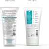 Dr Organic Skin Clear Exfoliating Scrub, Cleansing , For Acne & Clear Skin, Salicylic Acid, Oily, Problem Skin, Natural, Vegan, Cruelty-Free, Paraben & SLS-Free, Recycled & Recyclable, Organic, 150ml