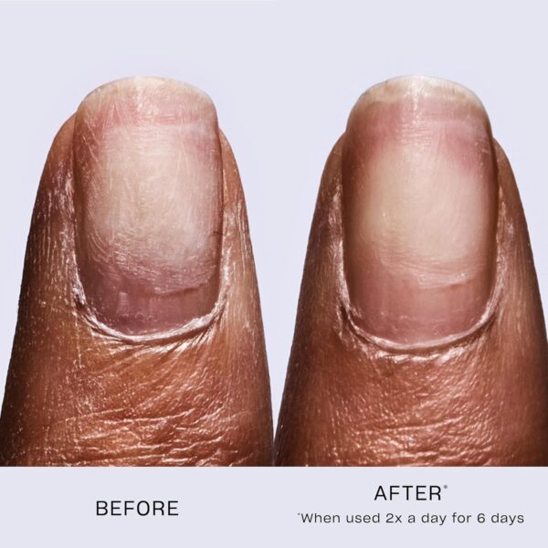 OPI Repair Mode Nail Polish Nail Repair and Strengthening Vegan Formula, Patented Bond Building Nail Serum Repairing 99% Of Nail Keratin, Professional Nail Strengthener for Damaged Nails, 9ml