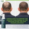 HairMD Transplant Clinical Repair Serum - 60ml Hair Regrowth Serum - Prevents Post-Transplant Hair Loss - Stimulates New Hair Growth - Fast and Effective Results - Gentle Formula