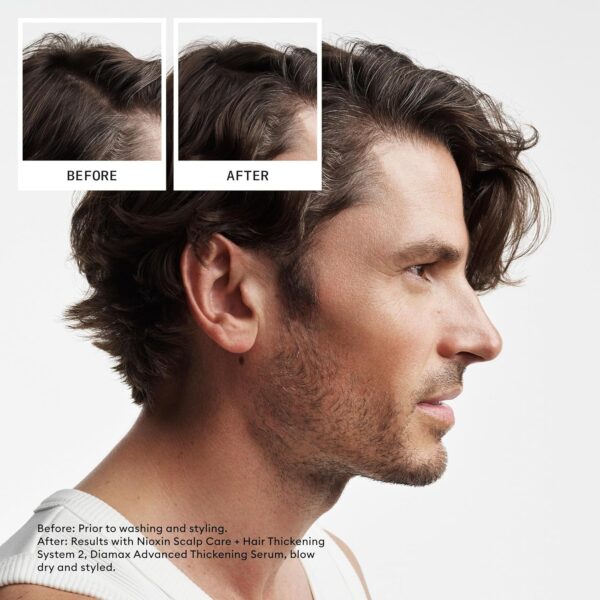 Nioxin Scalp + Hair Thickening System Kits | For Natural, Colored, & Damaged Hair with Light to Progressed Thinning | Strengthen & Boost Hair Density with Niacinamide & Biotin | 3 Month Supply